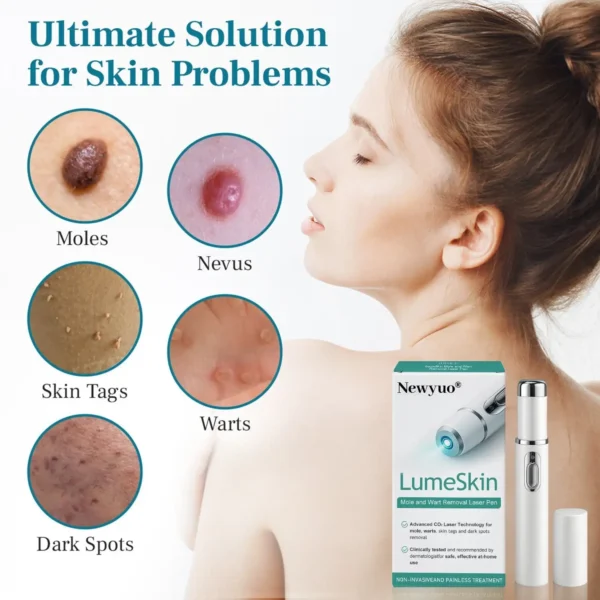 Newyuo® LumeSkin Mole and Wart Removal Laser Pen
