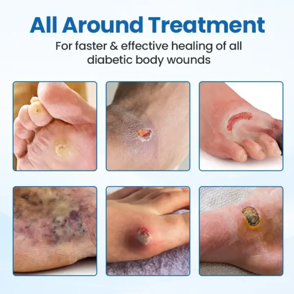 ✨[Official Store]✨ Glowrizon™ DiabeHeal Skin Recovery Band