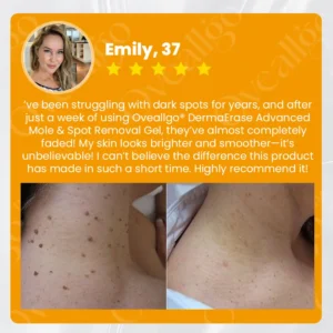 Oveallgo® EX DermaErase Advanced Mole & Spot Removal Gel