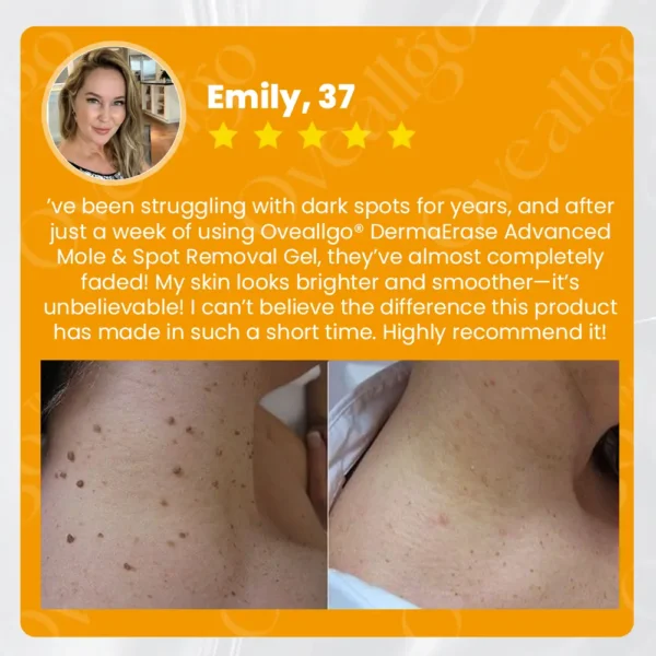 Oveallgo® EX DermaErase Advanced Mole & Spot Removal Gel