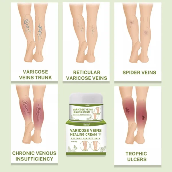 Timilk® Varicose Veins Healing Cream