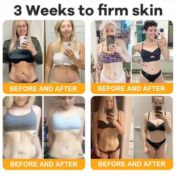 coastglee™ Bee Toxin Skin Regeneration Cream（🧑‍⚕️AAD Recommended🧑‍⚕️）