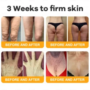 coastglee™ Bee Toxin Skin Regeneration Cream（🧑‍⚕️AAD Recommended🧑‍⚕️）