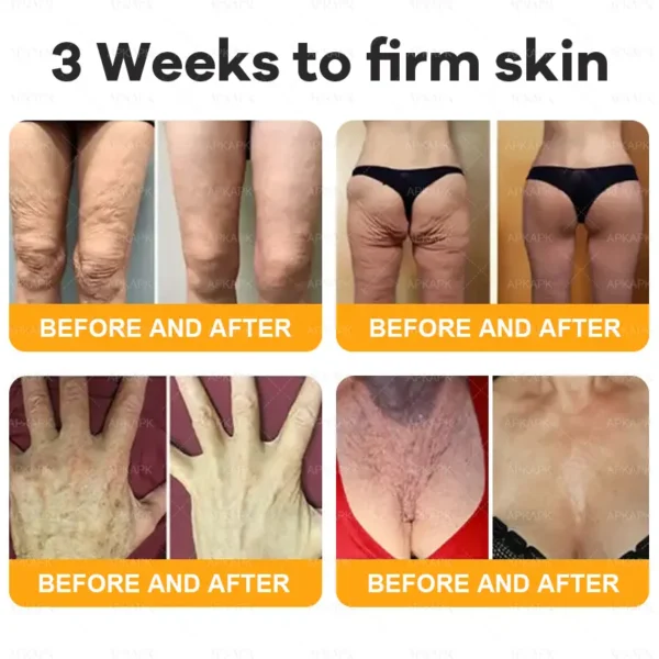 coastglee™ Bee Toxin Skin Regeneration Cream（🧑‍⚕️AAD Recommended🧑‍⚕️）