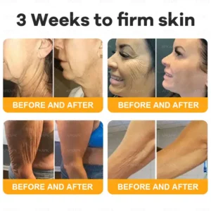 coastglee™ Bee Toxin Skin Regeneration Cream（🧑‍⚕️AAD Recommended🧑‍⚕️）
