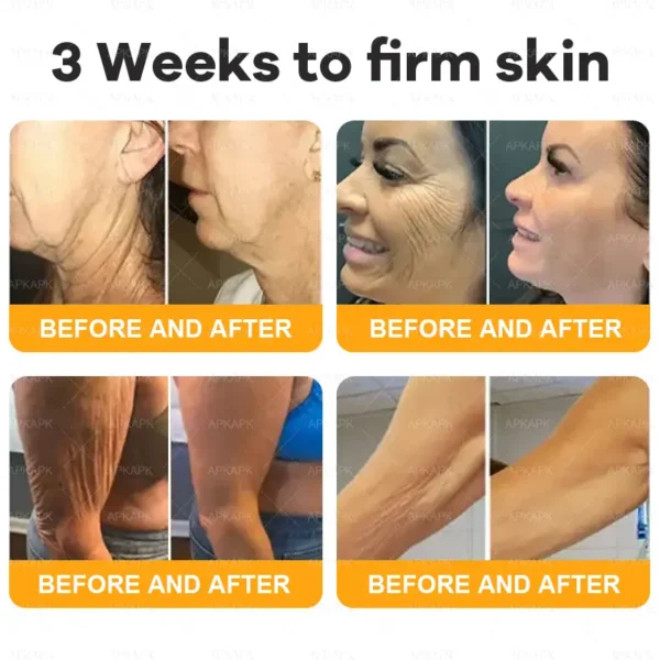 coastglee™ Bee Toxin Skin Regeneration Cream（🧑‍⚕️AAD Recommended🧑‍⚕️）