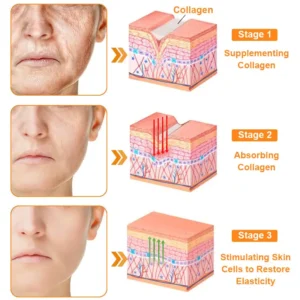 coastglee™ Bee Toxin Skin Regeneration Cream（🧑‍⚕️AAD Recommended🧑‍⚕️）