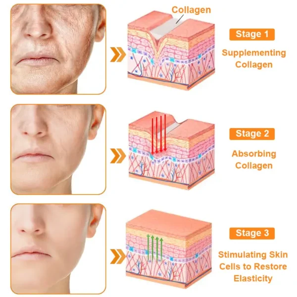 coastglee™ Bee Toxin Skin Regeneration Cream（🧑‍⚕️AAD Recommended🧑‍⚕️）