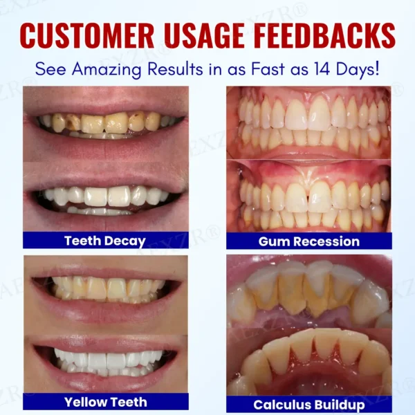 AEXZR® Baking Soda Oral Health Toothpaste