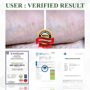 ATTDX® GenitalCare Badger Oil Therapeutic Balm
