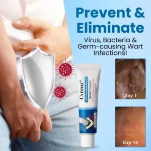 Cvreoz® HPV Genital Warts Relief Cream