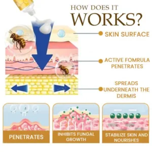 Glowrizon™ Bee Toxin Anti-Itch Cream（Unisex）
