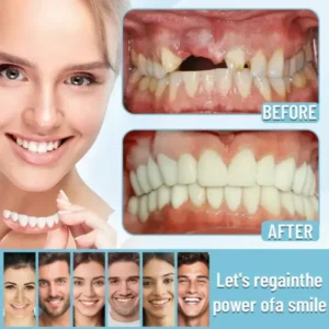 HEATWOLF® – Premium Customized Full Denture Set🦷-🏆🏆The Royal London Dental Hospital accreditation(🏆Limited Time Discount Last 30 Minutes🏆)
