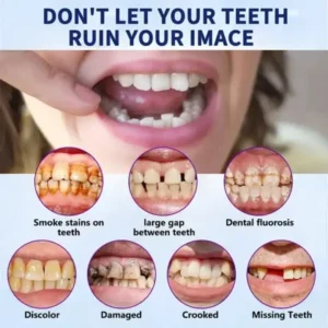 HEATWOLF® – Premium Customized Full Denture Set🦷-🏆🏆The Royal London Dental Hospital accreditation(🏆Limited Time Discount Last 30 Minutes🏆)