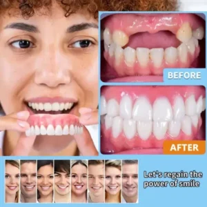 HEATWOLF® – Premium Customized Full Denture Set🦷-🏆🏆The Royal London Dental Hospital accreditation(🏆Limited Time Discount Last 30 Minutes🏆)