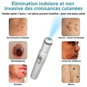 Recommandé par l’ANSM👩‍⚕️𝐤𝐢𝐝𝐬𝐧𝐞𝐞𝐝® 𝐆𝐫𝐚𝐢𝐧𝐬 𝐝𝐞 𝐛𝐞𝐚𝐮𝐭é 𝐞𝐭 𝐯𝐞𝐫𝐫𝐮𝐞𝐬 𝐧𝐨𝐧 𝐢𝐧𝐯𝐚𝐬𝐢𝐟𝐬 𝐒𝐭𝐲𝐥𝐨 𝐥𝐚𝐬𝐞𝐫 𝐝'é𝐥𝐢𝐦𝐢𝐧𝐚𝐭𝐢𝐨𝐧(Élimination rapide et indolore des verrues, grains de beauté, taches de vieillesse et excroissances cutanées — totalement sans effets secondaires)🎉