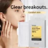 Slimoly+ Snail Pimple Acne Patch, 36 Patches