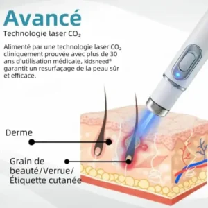 kidsneed® Stylo Laser Non Invasif pour l'Élimination des Grains de Beauté et des Verrues 🖊️