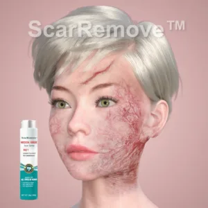 AEXZR™ Advanced Scar Spray