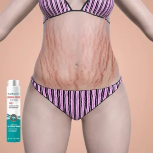 AEXZR™ Advanced Scar Spray