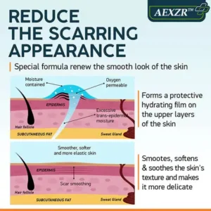 AEXZR™ Advanced Scar Spray