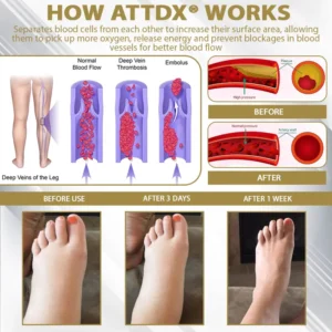 ATTDX® CortiEase Hormonal Swelling Balance Cream