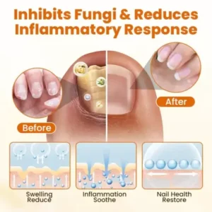 BBOJI™ FungiBee Advanced Nail Repair Spray