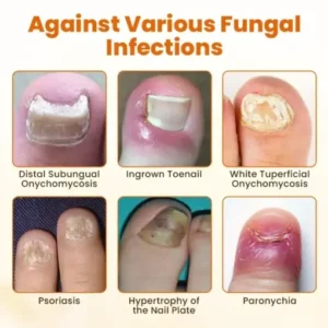 BBOJI™ FungiBee Advanced Nail Repair Spray