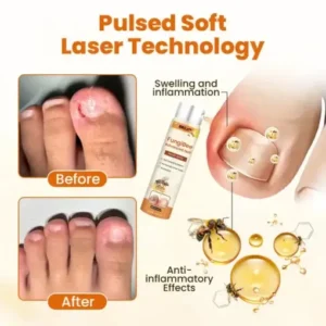 BBOJI™ FungiBee Advanced Nail Repair Spray