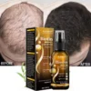Bloobeac®Hair Growth Serum