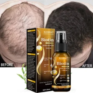 Bloobeac®Hair Growth Serum
