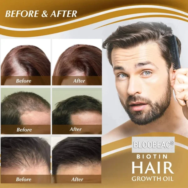 Bloobeac®Hair Growth Serum