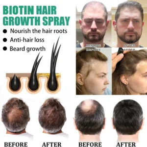 Bloobeac®Hair Growth Serum