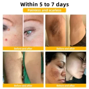Cvreoz® Bee Venom Skin Treatment Cream
