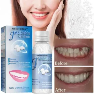 SmileFitPro™ Dental Filling Gel
