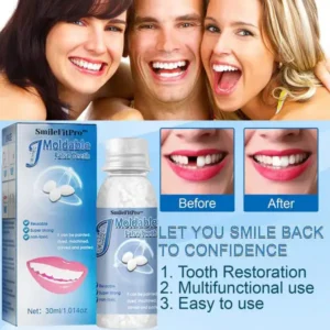 SmileFitPro™ Dental Filling Gel